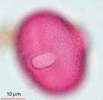 FICHE Palyno - Les Fabaceae Gastaldi, C. (ANSES, laboratoire de Sophia Antipolis, France), Cathala, T. (DRAAF Occitanie, France), Bui Thi Mai (CEPAM-CNRS, France), Girard, M. (CEPAM-CNRS, France)