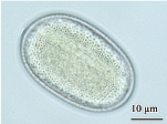Pollen de {Onobrychis viciaefolia} frais en vue équatoriale - <p>@ Gastaldi, C.- <span class="caps">ANSES</span>, 2021</p>