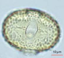 Fiche Palyno - Les Fabaceae Gastaldi, C. (ANSES, laboratoire de Sophia Antipolis, France), Cathala, T. (DRAAF Occitanie, France), Bui Thi Mai, Girard, M. (CEPAM-CNRS, France)