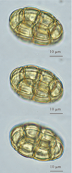 Pollen de {Acacia dealbata} acétolysé en vue équatoriale - <p>@ Gastaldi, C. - <span class="caps">ANSES</span>, 2018</p>