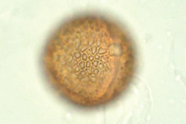 Observation et identification des grains de pollen