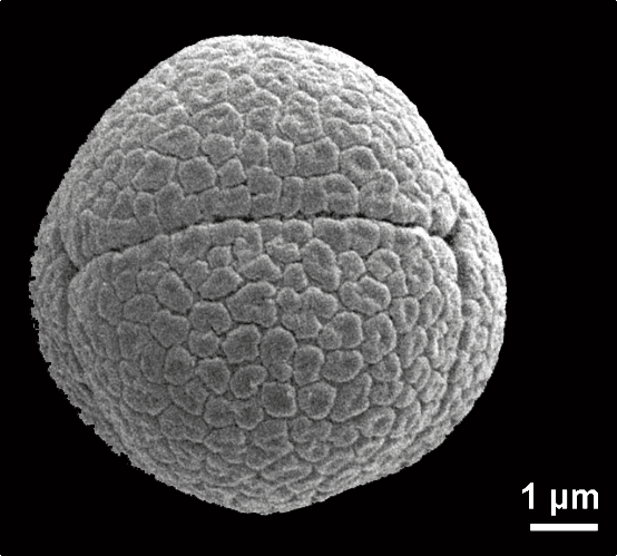 Pollen de {Mimosa pudica} en microscopie électronique - <p>@ Halbritter H., Heigl H. 2021</p>